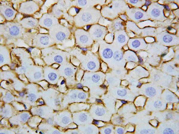 Immunohistochemistry of Anti-Annexin V